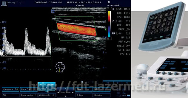 Узи сосудов шеи москва